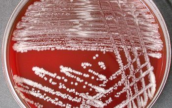 Corynebacterium amycolatum  culture incubated with O2