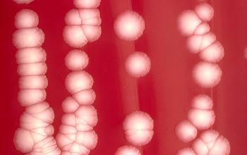 Corynebacterium amycolatum  culture incubated with O2