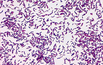 Corynebacterium diphtheriae Gram stain