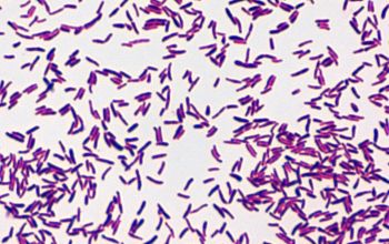 Corynebacterium diphtheriae Gram stain