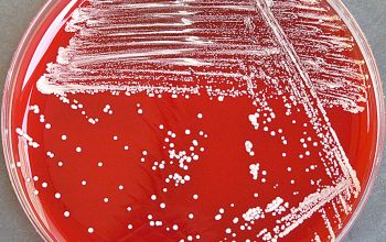 Corynebacterium durum Blood Agar 24h culture incubated with CO2