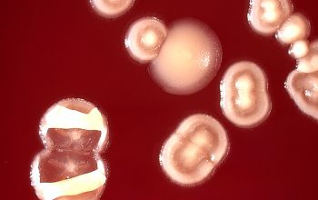 Corynebacterium durum Blood Agar 48h culture incubated with CO2