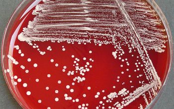 Corynebacterium durum  culture incubated with CO2