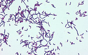 Corynebacterium durum Gram stain