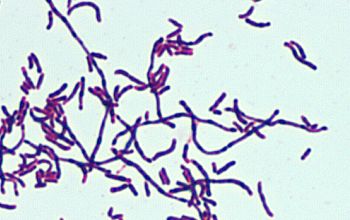 Corynebacterium durum Gram stain