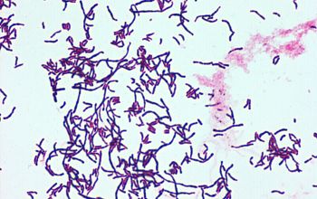 Corynebacterium durum Gram stain