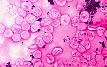 Corynebacterium jekeium Gram stain