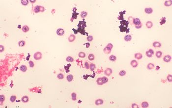 Corynebacterium mucifaciens Gram stain