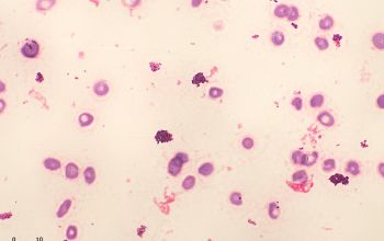 Corynebacterium mucifaciens Gram stain