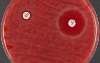 Corynebacterium mucifaciens Blood Agar 24h culture incubated with O2