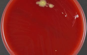 Corynebacterium mucifaciens Blood Agar 48h culture incubated with O2