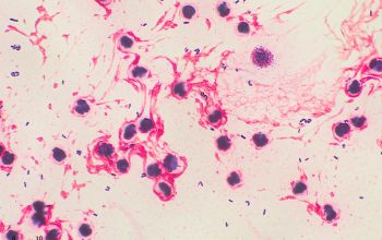 Corynebacterium propinquum Gram stain