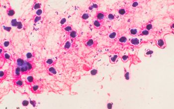 Corynebacterium propinquum Gram stain