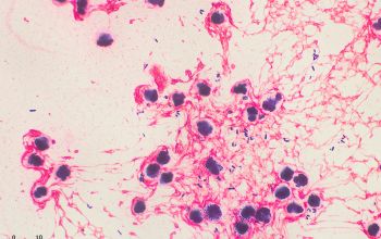 Corynebacterium propinquum Gram stain