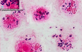 Corynebacterium pseudodiphteriticum Gram stain