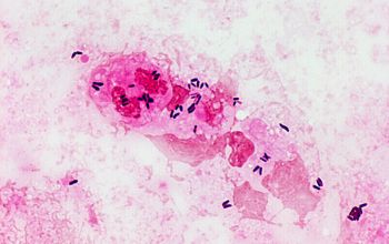 Corynebacterium pseudodiphteriticum Gram stain