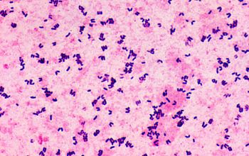 Corynebacterium pseudodiphteriticum Gram stain