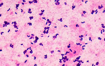 Corynebacterium pseudodiphteriticum Gram stain