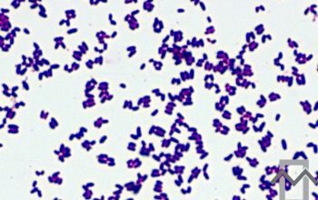 Corynebacterium striatum Gram stain