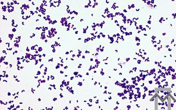 Corynebacterium striatum Gram stain