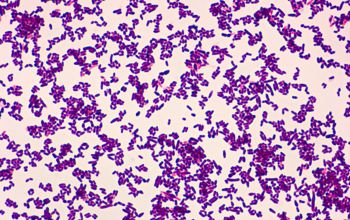 Corynebacterium ulcerans Gram stain