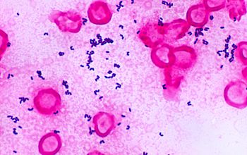 Corynebacterium urealyticum Gram stain