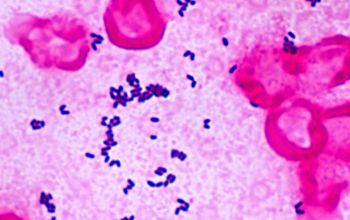 Corynebacterium urealyticum Gram stain