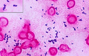 Corynebacterium urealyticum Gram stain