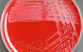 Corynebacterium urealyticum Blood Agar 24h culture incubated with CO2