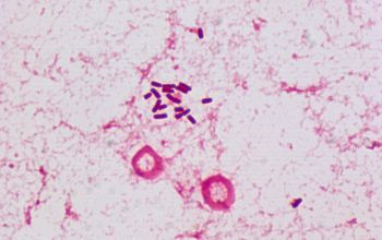 Cronobacter sakazakii Gram stain