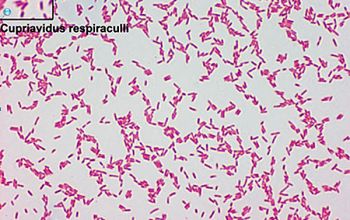 Cupriavidus respiraculi Gram stain