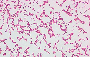 Cupriavidus respiraculi Gram stain