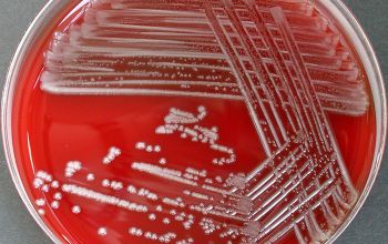 Delftia acidovorans Blood Agar 48h culture incubated with O2