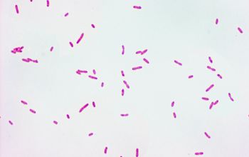 Delftia acidovorans Gram stain