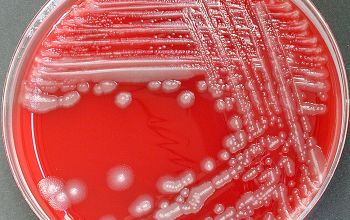 Delftia acidovorans Blood Agar 48h culture incubated with O2