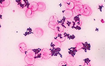 Dermabacter hominis Gram stain