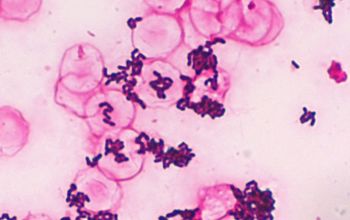 Dermabacter hominis Gram stain