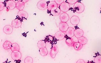 Dermabacter hominis Gram stain