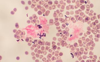 Eggerthia catenaformis Gram stain