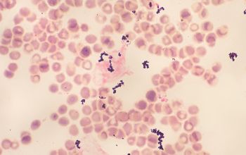 Eggerthia catenaformis Gram stain