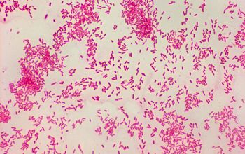 Eikenella corrodens Gram stain