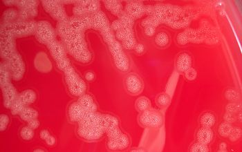 Eikenella corrodens Blood Agar 24h culture incubated with CO2