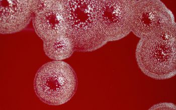 Eikenella corrodens Blood Agar 48h culture incubated with CO2