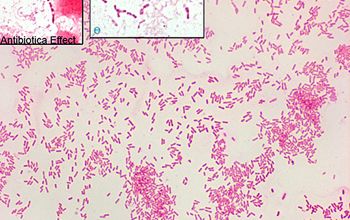 Eikenella corrodens Gram stain