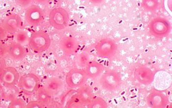 Eikenella corrodens Gram stain