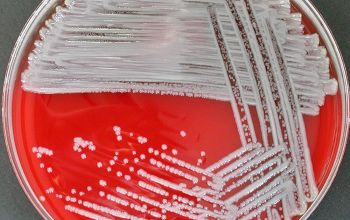 Elizabethkingia meningoseptica Blood Agar 24h culture incubated with CO2