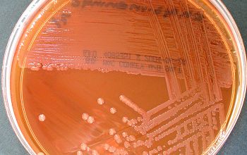 Elizabethkingia meningoseptica Mac Conkey Agar without salt 48h culture incubated with O2