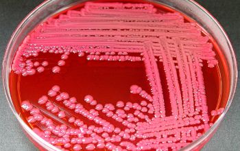 Enterobacter aerogenes Mac Conkey Agar without salt 24h culture incubated with O2