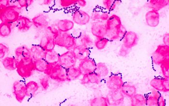 Enterococcus faecalis Gram stain