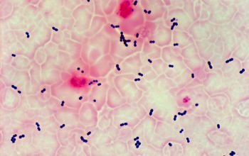 Enterococcus faecalis Gram stain